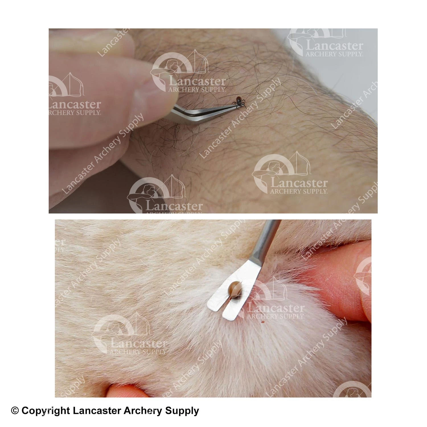 TickEase Tick Remover Tool 2 TickEase Tick Remover Tool - Image 2